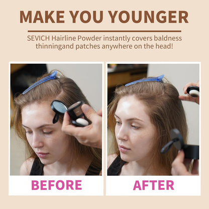 ✨Hairline Powder✨ Instant Concealer for Thinning Gray Hair, Windproof Sweatproof for Men & Women