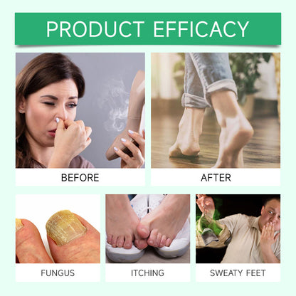 Tea Tree Oil Foot Spray 🌿 - Moisturizing Deodorant for Fresh Feet 🦶✨