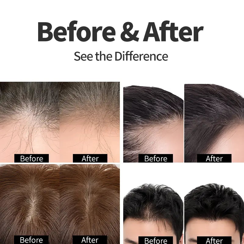 ✨Hairline Powder✨ Instant Concealer for Thinning Gray Hair, Windproof Sweatproof for Men & Women