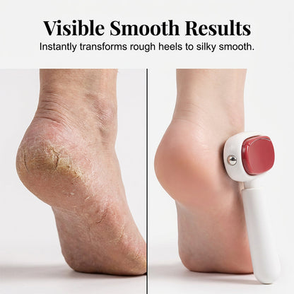 🔥LAST DAY 49% OFF🔥🦶Double-Sided Foot Scraper for Callus Removal| Replaceable Stainless Steel Foot Scraper