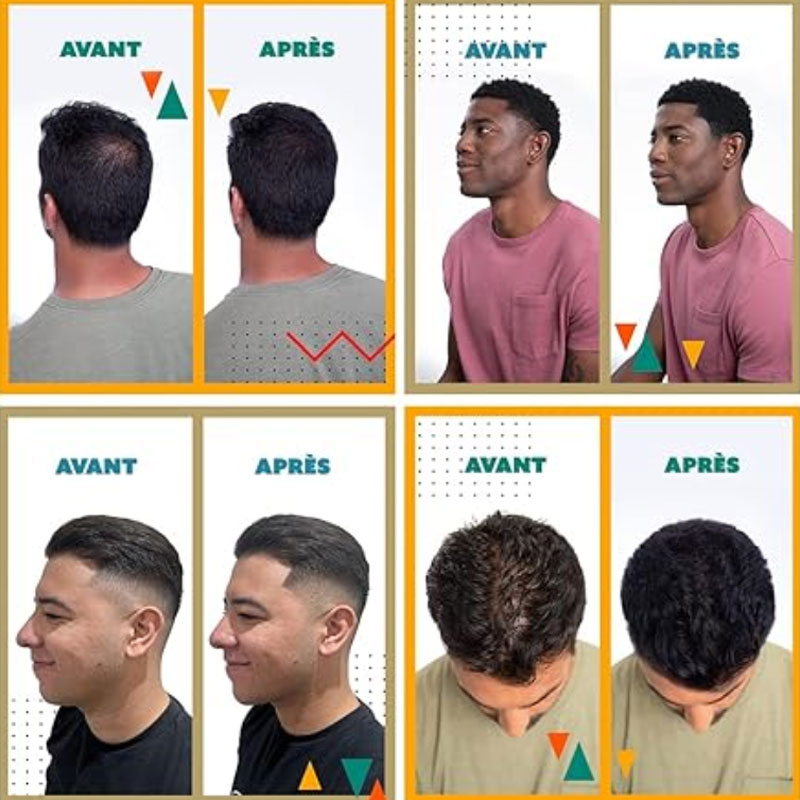 🔥 49% OFF Limited Time🔥Hair Building Fibers – Instant Thickness & Waterproof Design, No More Bald Spots