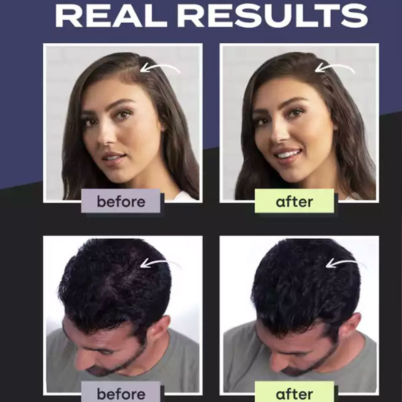 🔥 49% OFF Limited Time🔥Hair Building Fibers – Instant Thickness & Waterproof Design, No More Bald Spots